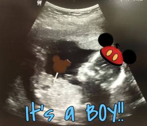 It's a Boy